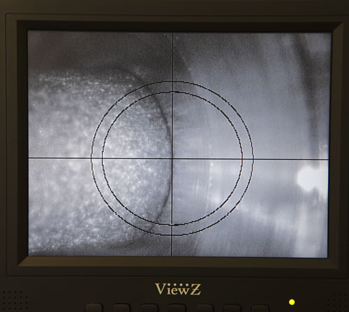 laser-1-processing
                                   